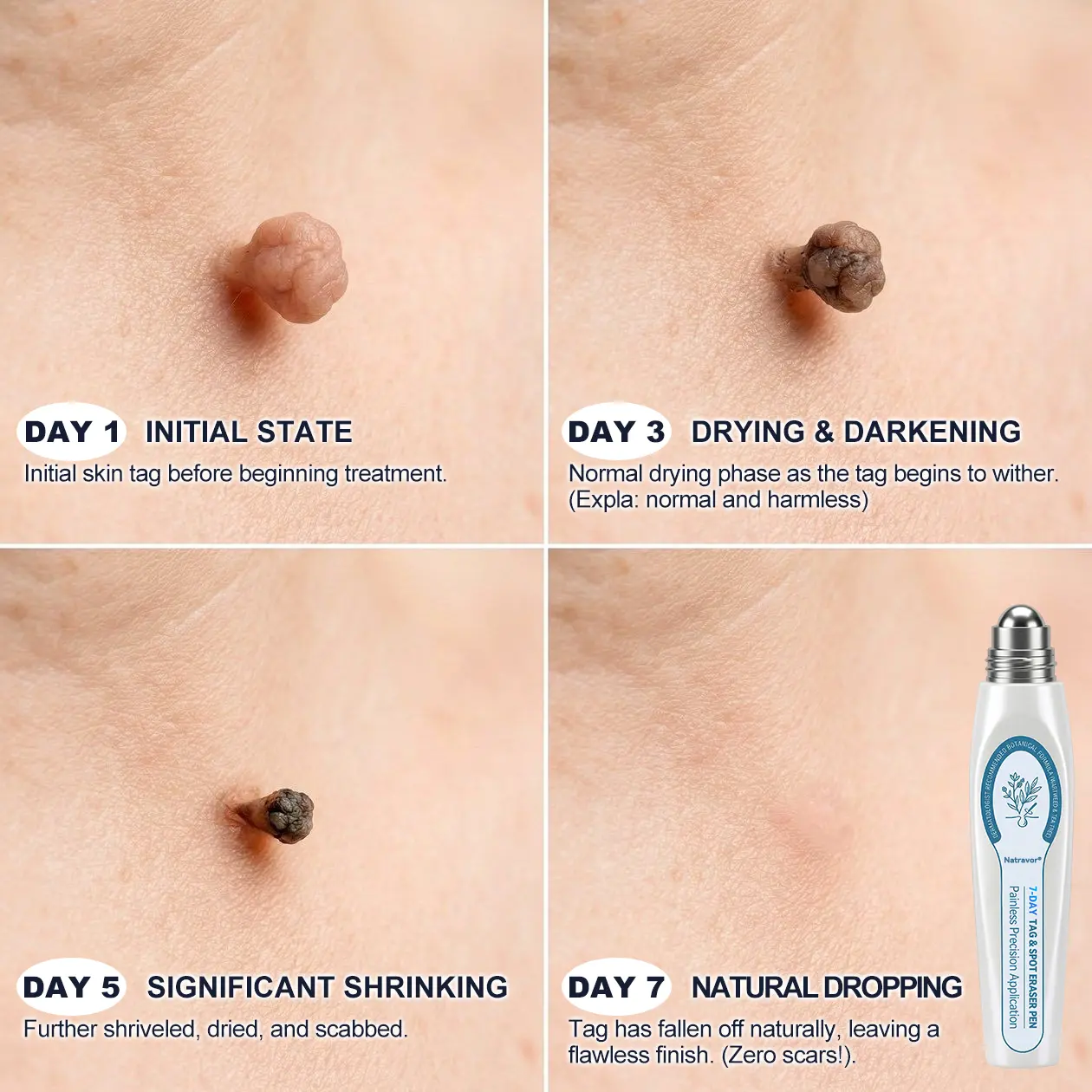 7-Day Tag & Spot Eraser Rollerball - Image 4
