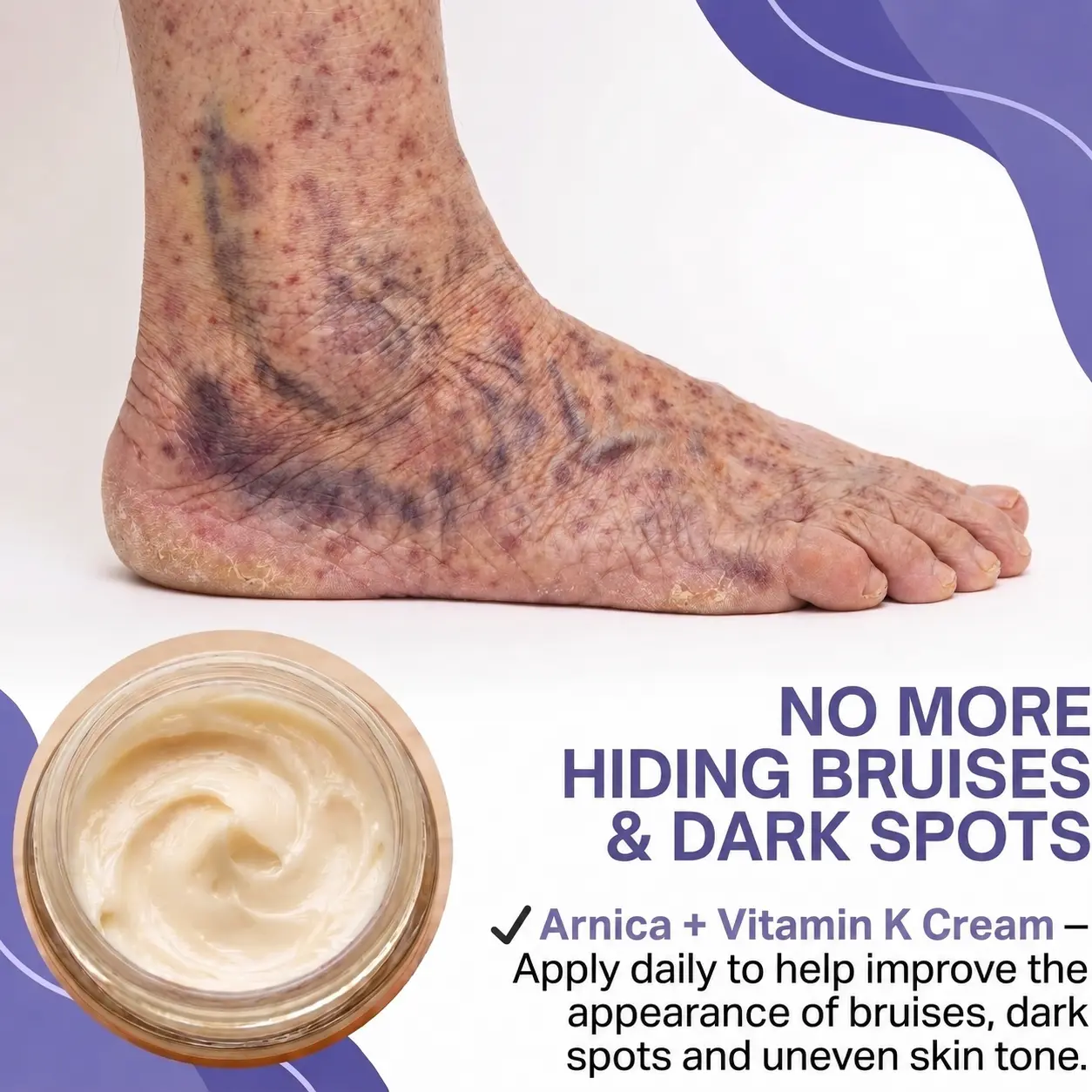 All-New Upgraded Dark Spot Correcting - Bruise Healing & Skin Strengthening Cream - Image 3