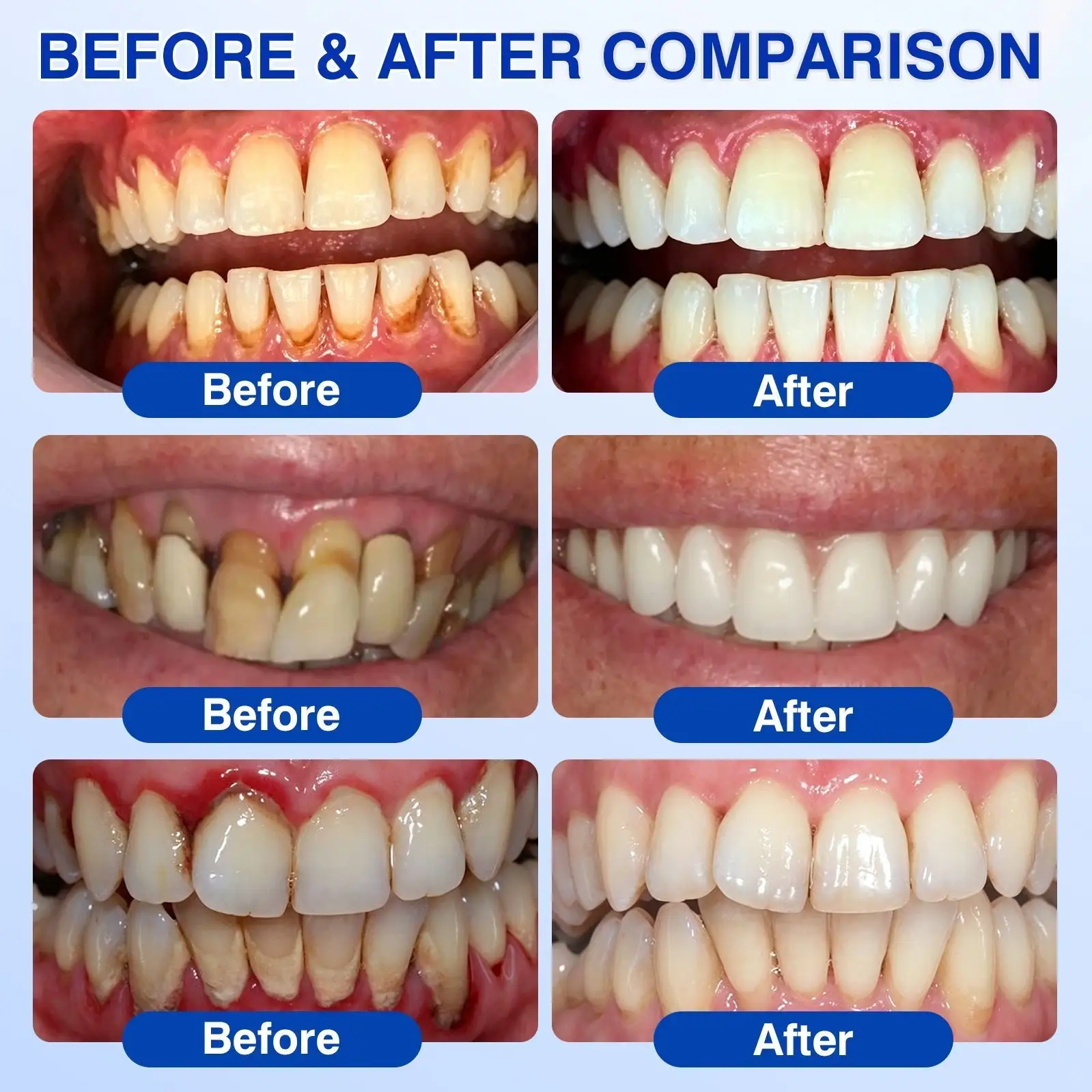 Tiworld ® Gum health Periodontal Repair Gel - Image 4