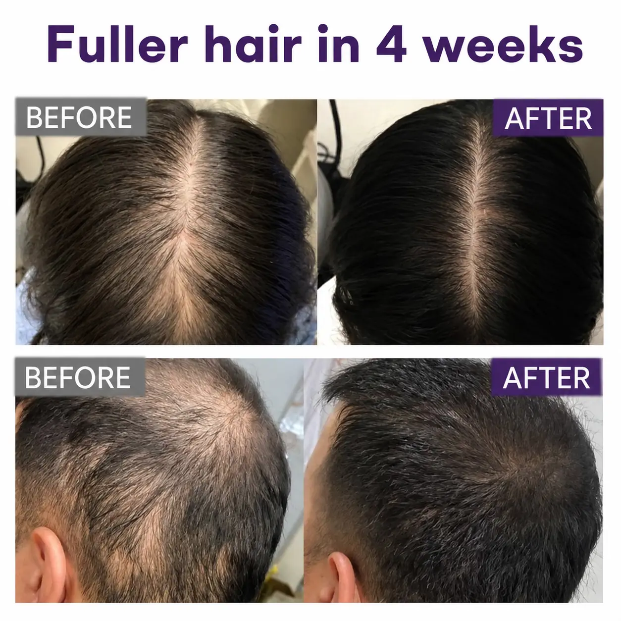 Black Rice & Red Onion Hair Growth Spray - Image 4