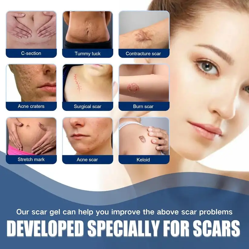 NESLEMY Scar Removel Gel Smoothing Skin Hydrate & Moisturize - Image 7
