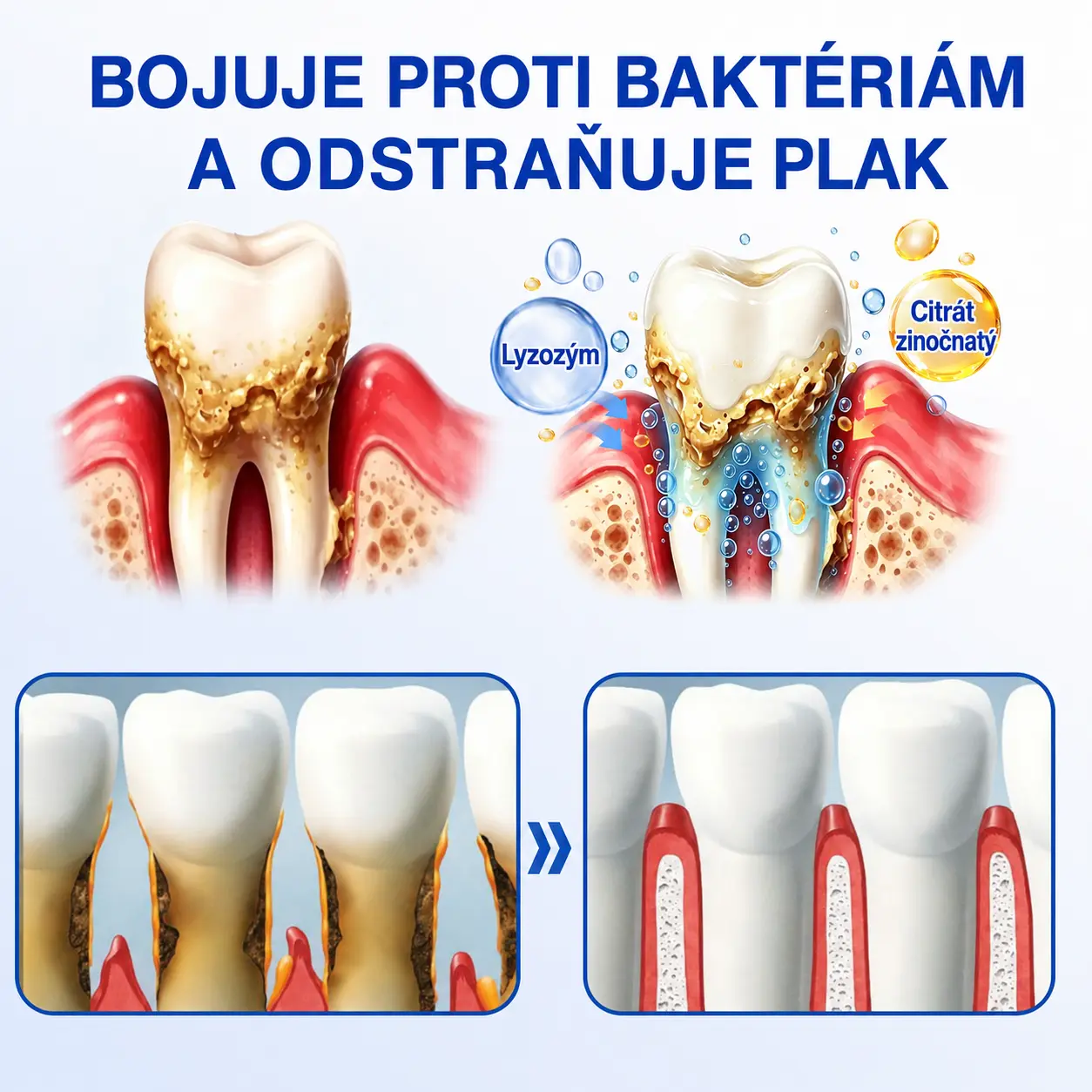 GumRevive Parodontálny opravný gél - Image 8