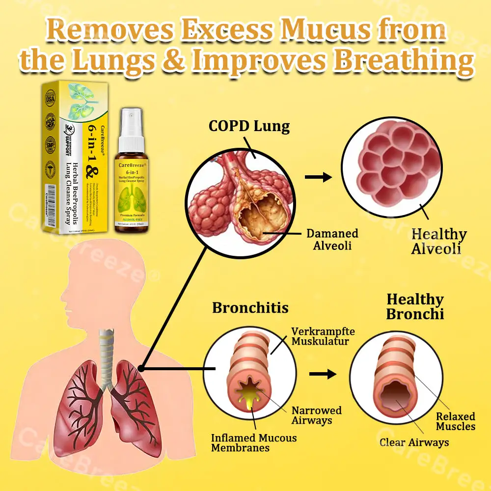 6-in-1 Herbal BeePropolis Lung Cleanse Spray - Image 8